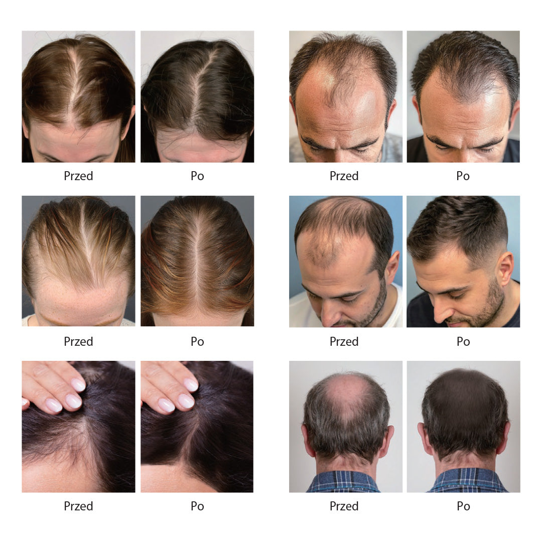 Beaver Serum Zapobiegające Wypadaniu Włosów